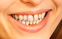 periodoncia moderada