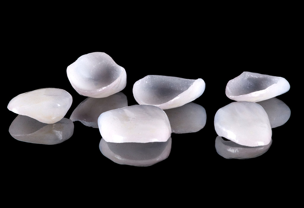 bruxismo en Barajas - Madrid