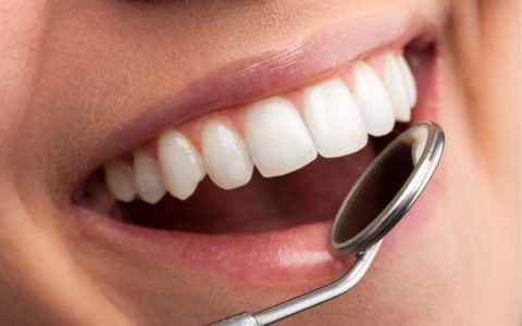 Dientes con manchas blancas: Tratamientos y prevención