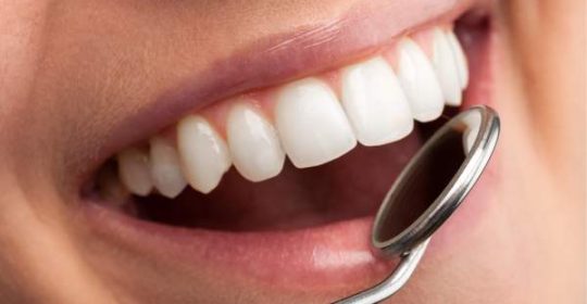 Dientes con manchas blancas: Tratamientos y prevención