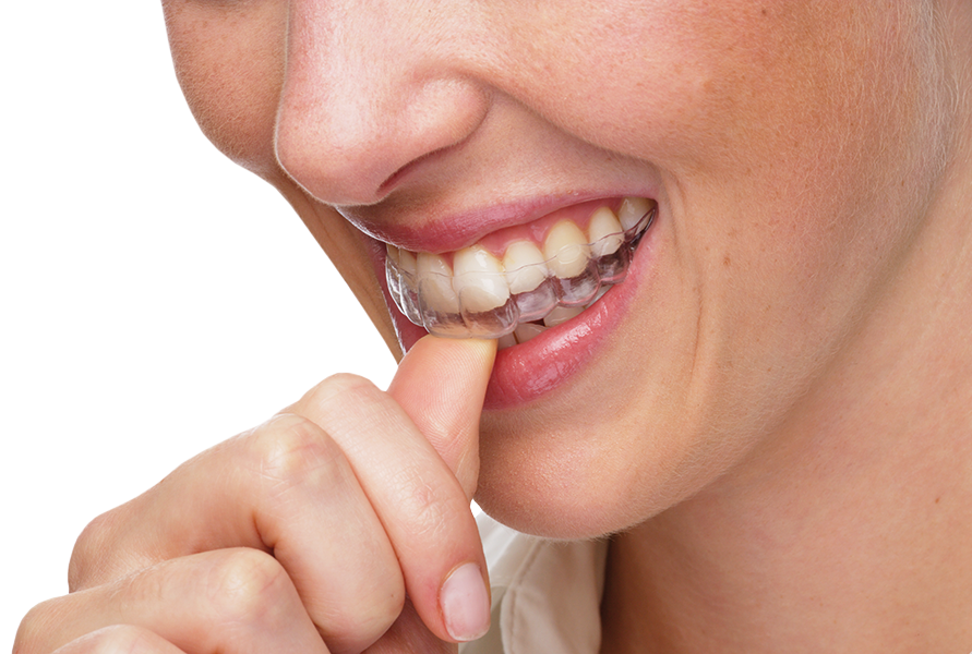 promoción ortodoncia invisalign