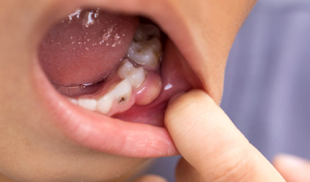 Urgencias dentales en Barajas
