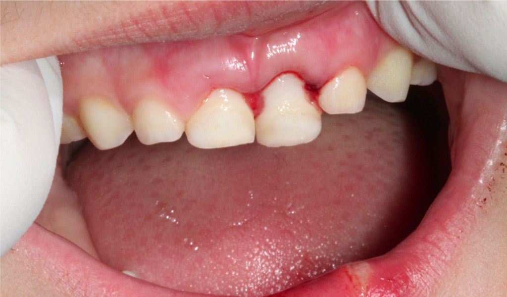 Urgencias dentales en Barajas