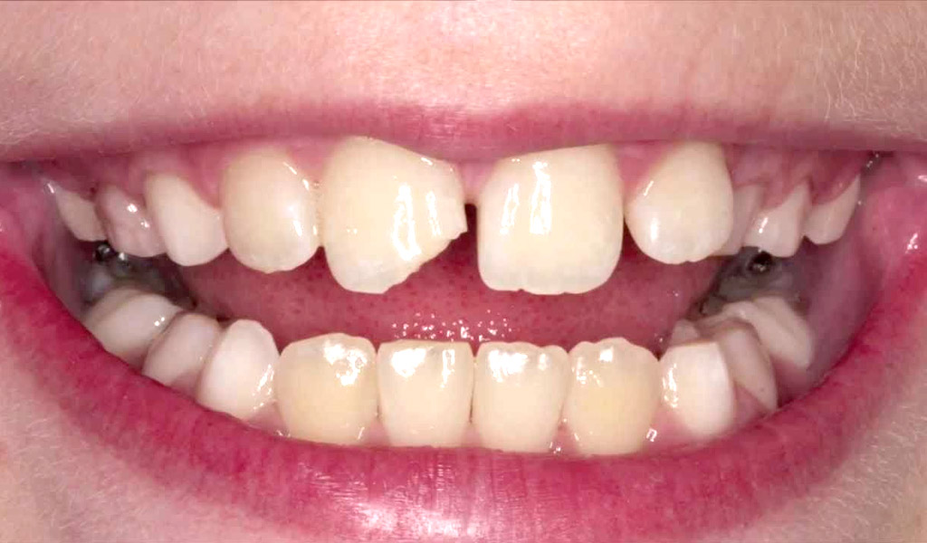 Urgencias dentales en Barajas